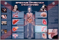 Электрифицированный стенд "Вредные привычки: алкоголизм" - «globural.ru» - Ивантеевка